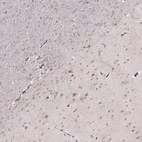 Immunohistochemical staining of human cerebral cortex shows moderate cytoplasmic and nuclear positivity in neuronal and glial cells.