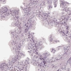 Immunohistochemical staining of human prostate shows no nuclear positivity in glandular cells.