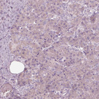 Anti-EGR4 Antibody