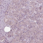 Immunohistochemical staining of human pancreas shows no nuclear positivity in exocrine glandular cells as expected.