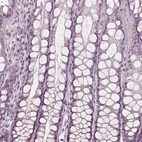 Immunohistochemical staining of human colon shows no positivity in glandular cells as expected.