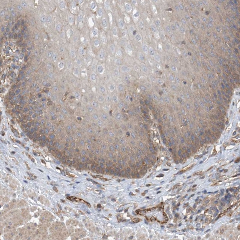 Anti-PHACTR4 Antibody