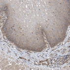 Anti-PHACTR4 Antibody