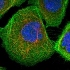 Immunofluorescent staining of human cell line A-431 shows localization to plasma membrane & cytosol.