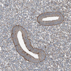 Immunohistochemical staining of human endometrium shows moderate to strong granular cytoplasmic positivity in glandular cells.