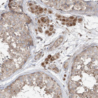 Anti-SAMD3 Antibody