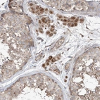 Immunohistochemical staining of human testis shows moderate to strong granular cytoplasmic positivity in Leydig cells.