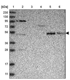 Lane 1: Marker [kDa] 230, 130, 95, 72, 56, 36, 28, 17, 11_br/_Lane 2: Human cell line RT-4_br/_Lane 3: Human cell line U-251MG sp_br/_Lane 4: Human plasma (IgG/HSA depleted)_br/_Lane 5: Human liver tissue_br/_Lane 6: Human tonsil tissue