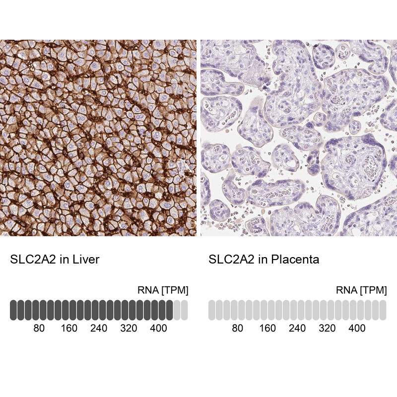 Anti-SLC2A2 Antibody
