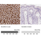 Anti-SLC2A2 Antibody