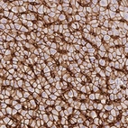 Immunohistochemical staining of human liver shows strong membranous positivity in hepatocytes.