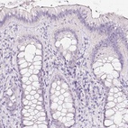Immunohistochemical staining of human colon shows low expression as expected.