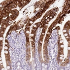 Immunohistochemical staining of human duodenum shows strong membranous positivity in glandular cells.