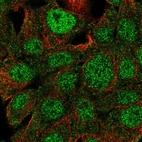 Immunofluorescent staining of human cell line Hep G2 shows localization to nucleoplasm & cytosol.