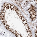 Anti-ZNF470 Antibody