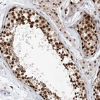 Anti-ZNF470 Antibody