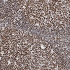 Immunohistochemical staining of human tonsil shows strong nuclear positivity.
