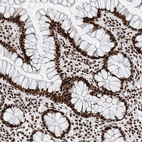 Immunohistochemical staining of human gastrointestinal shows strong nuclear positivity in glandular cells.