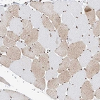 Immunohistochemical staining of human skeletal muscle shows moderate nuclear positivity in myocytes.