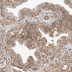 Immunohistochemical staining of human prostate shows moderate membranous positivity in glandular cells.