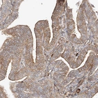 Immunohistochemical staining of human Fallopian tube shows moderate membranous positivity in glandular cells.