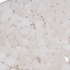 Immunohistochemical staining of human skeletal muscle shows very weak positivity in myocytes as expected.