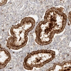 Anti-RNASET2 Antibody