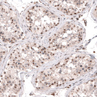 Anti-SMYD2 Antibody