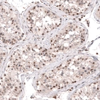 Anti-SMYD2 Antibody