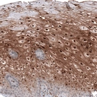 Immunohistochemical staining of human uterine cervix shows moderate to strong nuclear positivity in squamous epithelial cells.