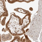 Immunohistochemical staining of human placenta shows moderate to strong cytoplasmic and nuclear positivity in trophoblastic cells.