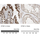 Anti-ETHE1 Antibody