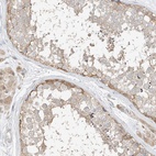 Immunohistochemical staining of human testis shows low expression as expected.