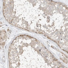 Immunohistochemical staining of human testis shows low expression as expected.