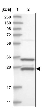 Lane 1: Marker [kDa] 230, 130, 95, 72, 56, 36, 28, 17, 11_br/_Lane 2: Human cell line RT-4