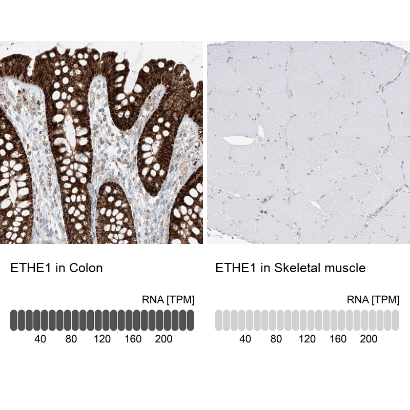 Anti-ETHE1 Antibody