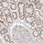 Immunohistochemical staining of human kidney shows moderate granular cytoplasmic positivity in cells in tubules.
