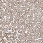 Immunohistochemical staining of human liver shows moderate granular cytoplasmic positivity in hepatocytes.