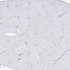 Immunohistochemical staining of human skeletal muscle shows no positivity in myocytes as expected.