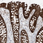 Immunohistochemical staining of human colon shows strong granular cytoplasmic positivity in glandular cells.