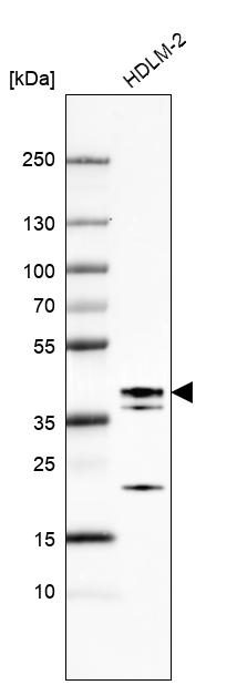 Anti-ETV7 Antibody