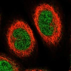 Immunofluorescent staining of human cell line A-431 shows localization to nucleoplasm.