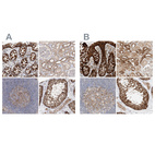 Anti-CARMIL1 Antibody