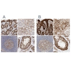 Anti-CARMIL1 Antibody