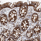 Immunohistochemical staining of human colon shows strong cytoplasmic positivity in glandular cells.