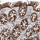 Immunohistochemical staining of human colon shows strong cytoplasmic positivity in glandular cells.