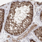 Immunohistochemical staining of human testis shows strong cytoplasmic positivity in cells in seminiferous ducts.