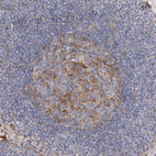 Immunohistochemical staining of human lymph node shows strong membranous positivity in germinal center cells.