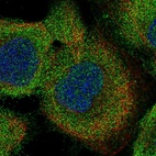 Immunofluorescent staining of human cell line A-431 shows localization to cytosol.