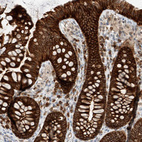 Immunohistochemical staining of human colon shows strong cytoplasmic positivity in glandular cells.